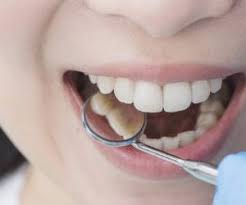 چه عواملی باعث پوسیدگی دندان می شود صفحه ۹۶ کتاب سلامت وبهداشت